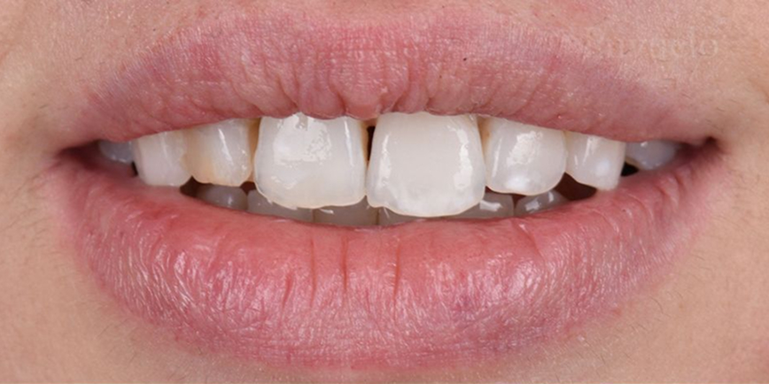cirugia oral 1