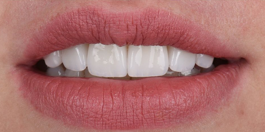 cirugia oral 2