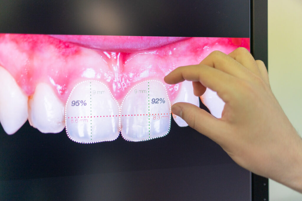tac dental 3d