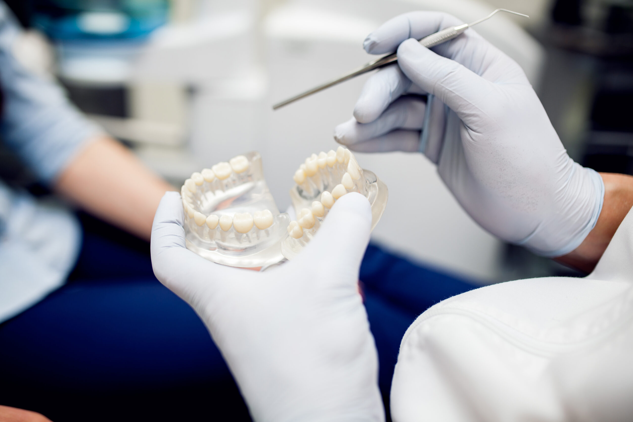 implantes dentales