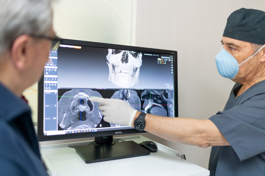 implantes dentales